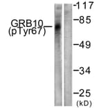 Western Blot - Anti-GRB10 (phospho Tyr67) Antibody (A1031) - Antibodies.com