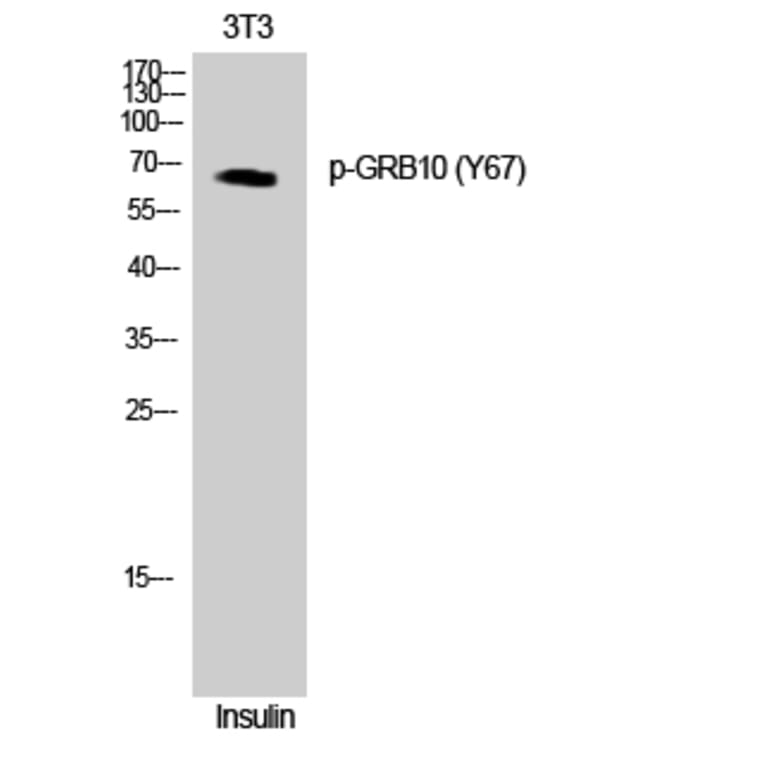 Western Blot - Anti-GRB10 (phospho Tyr67) Antibody (A1031) - Antibodies.com