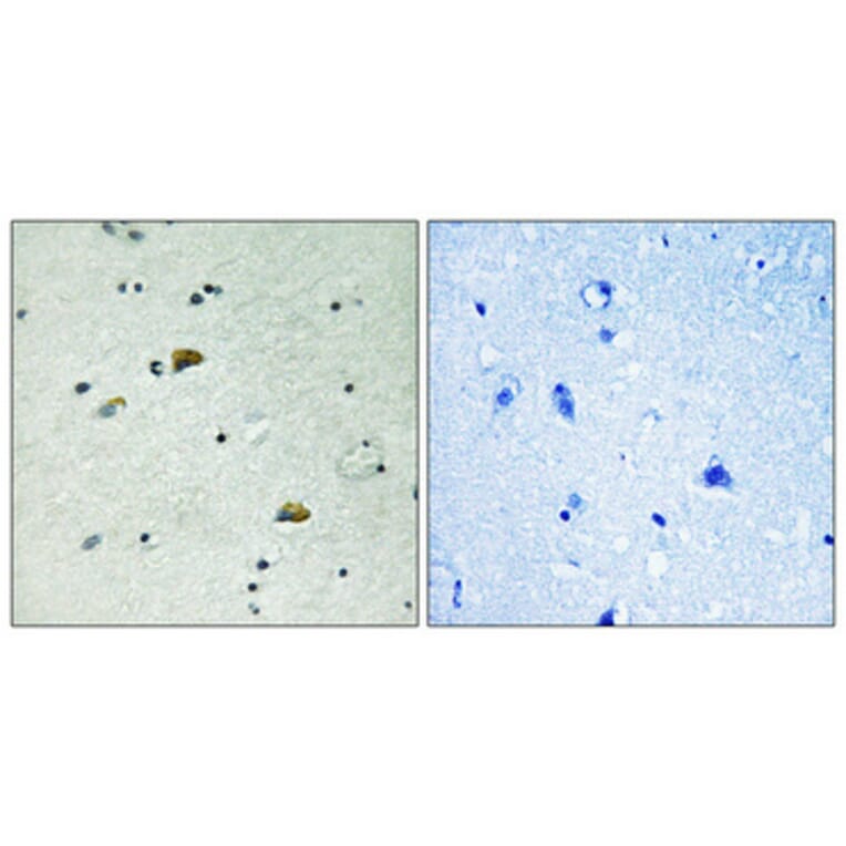 Immunohistochemistry - Anti-GRB10 (phospho Tyr67) Antibody (A1031) - Antibodies.com