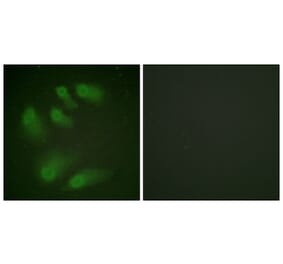 Immunofluorescence - Anti-Chk1 (phospho Ser286) Antibody (A0861) - Antibodies.com