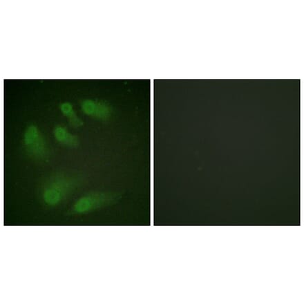Immunofluorescence - Anti-Chk1 (phospho Ser286) Antibody (A0861) - Antibodies.com