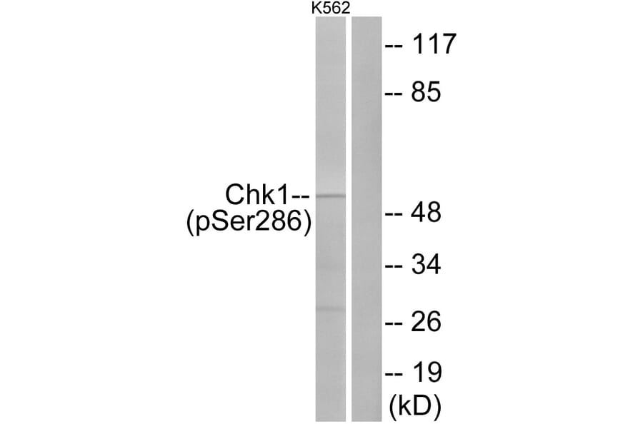 Western Blot - Anti-Chk1 (phospho Ser286) Antibody (A0861) - Antibodies.com