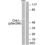 Western Blot - Anti-Chk1 (phospho Ser286) Antibody (A0861) - Antibodies.com