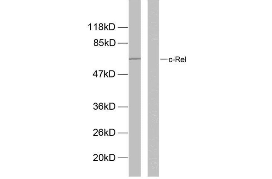 Western Blot - Anti-Rel (phospho Ser503) Antibody (A7211) - Antibodies.com