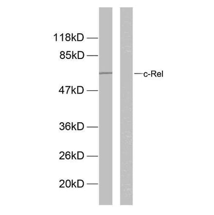 Western Blot - Anti-Rel (phospho Ser503) Antibody (A7211) - Antibodies.com