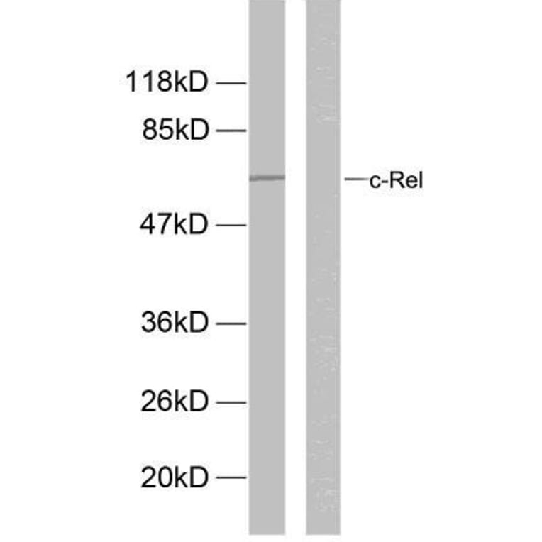 Western Blot - Anti-Rel (phospho Ser503) Antibody (A7211) - Antibodies.com