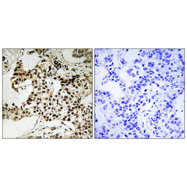 Immunohistochemistry - Anti-PKR (phospho Thr258) Antibody (A8174) - Antibodies.com