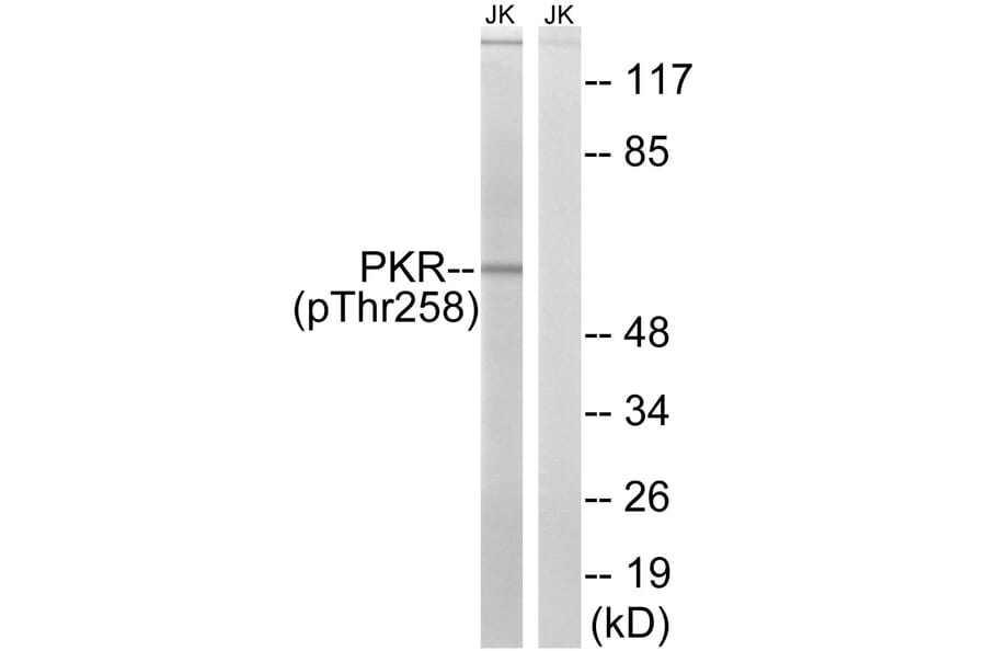 Western Blot - Anti-PKR (phospho Thr258) Antibody (A8174) - Antibodies.com