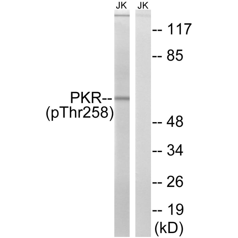 Western Blot - Anti-PKR (phospho Thr258) Antibody (A8174) - Antibodies.com