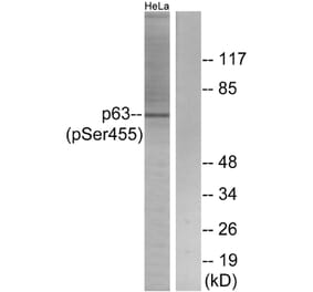 Western Blot - Anti-p63 (phospho Ser455) Antibody (A0703) - Antibodies.com