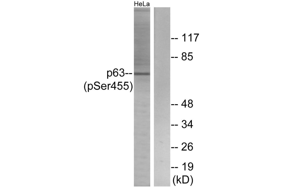 Western Blot - Anti-p63 (phospho Ser455) Antibody (A0703) - Antibodies.com