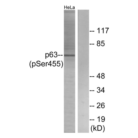 Western Blot - Anti-p63 (phospho Ser455) Antibody (A0703) - Antibodies.com