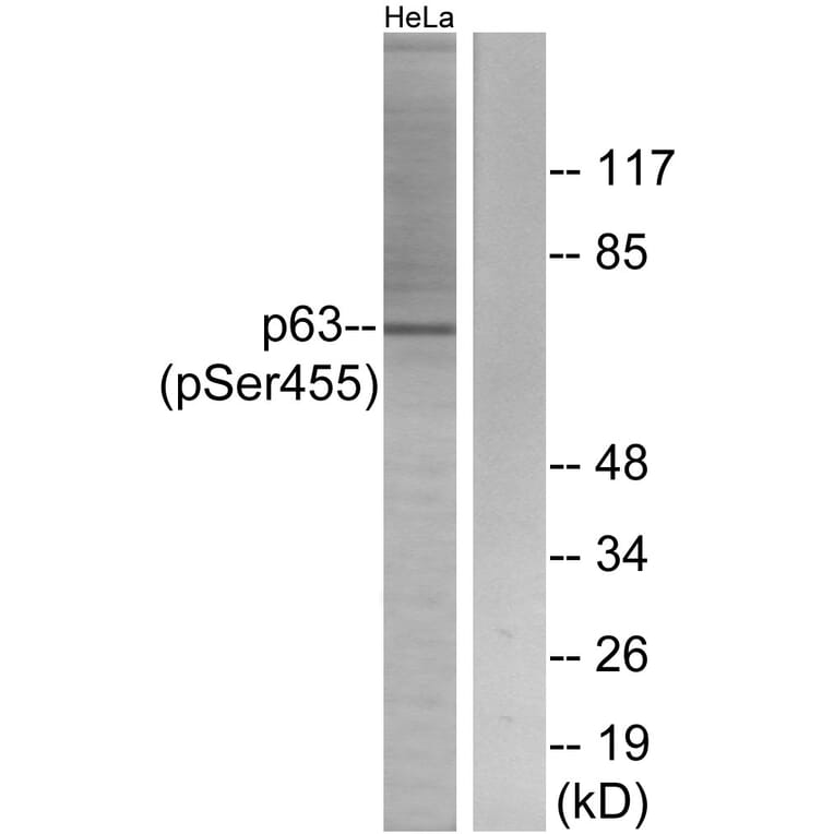 Western Blot - Anti-p63 (phospho Ser455) Antibody (A0703) - Antibodies.com