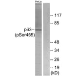 Western Blot - Anti-p63 (phospho Ser455) Antibody (A0703) - Antibodies.com