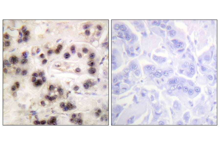 Immunohistochemistry - Anti-p63 (phospho Ser455) Antibody (A0703) - Antibodies.com