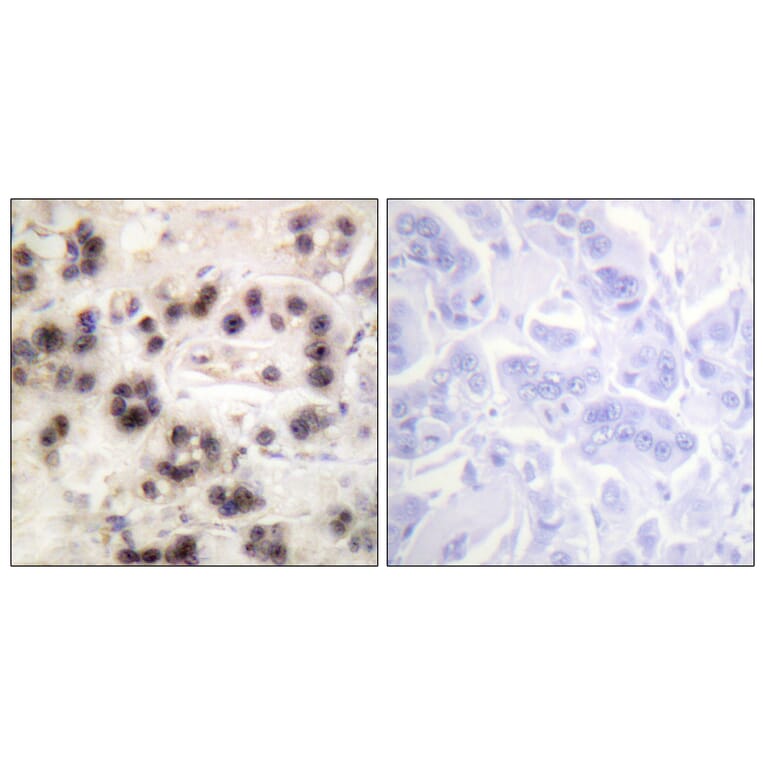 Immunohistochemistry - Anti-p63 (phospho Ser455) Antibody (A0703) - Antibodies.com