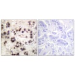 Immunohistochemistry - Anti-p63 (phospho Ser455) Antibody (A0703) - Antibodies.com