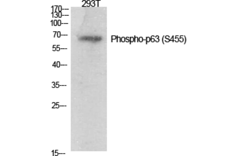 Western Blot - Anti-p63 (phospho Ser455) Antibody (A0703) - Antibodies.com