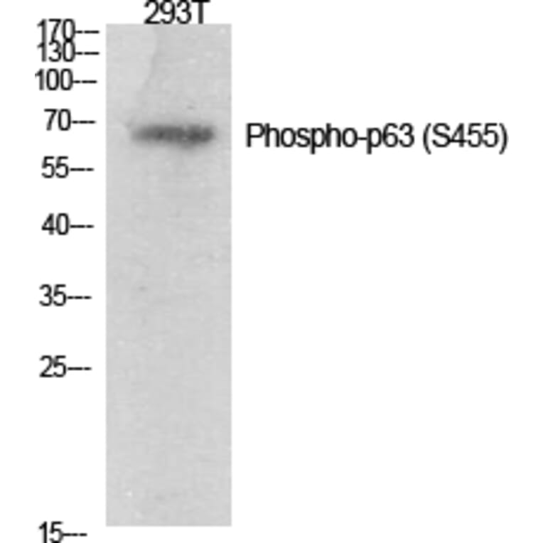 Western Blot - Anti-p63 (phospho Ser455) Antibody (A0703) - Antibodies.com