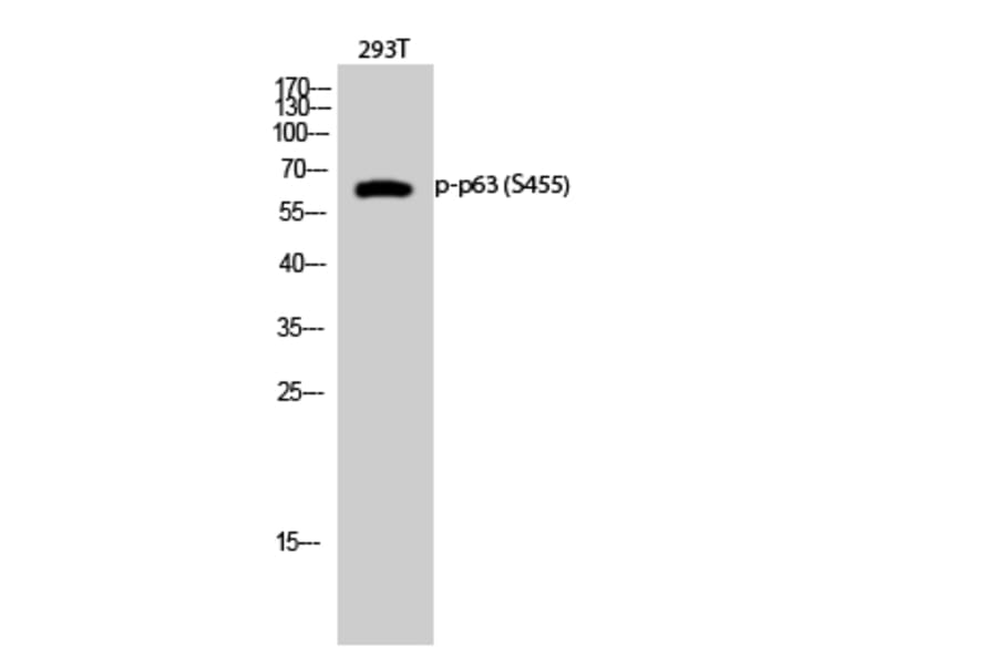 Western Blot - Anti-p63 (phospho Ser455) Antibody (A0703) - Antibodies.com
