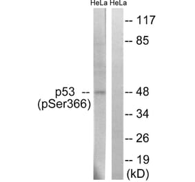 Western Blot - Anti-p53 (phospho Ser366) Antibody (A8053) - Antibodies.com
