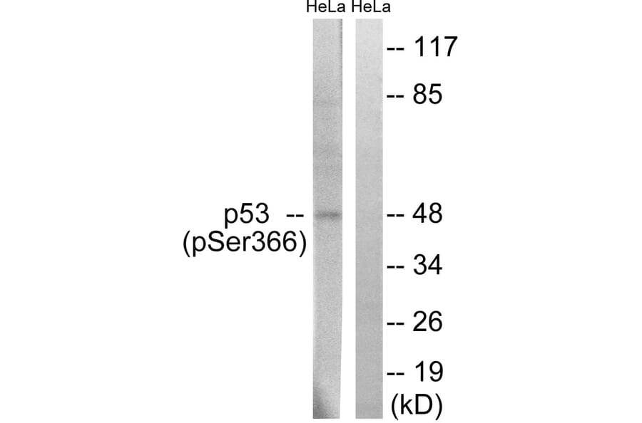 Western Blot - Anti-p53 (phospho Ser366) Antibody (A8053) - Antibodies.com