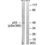 Western Blot - Anti-p53 (phospho Ser366) Antibody (A8053) - Antibodies.com