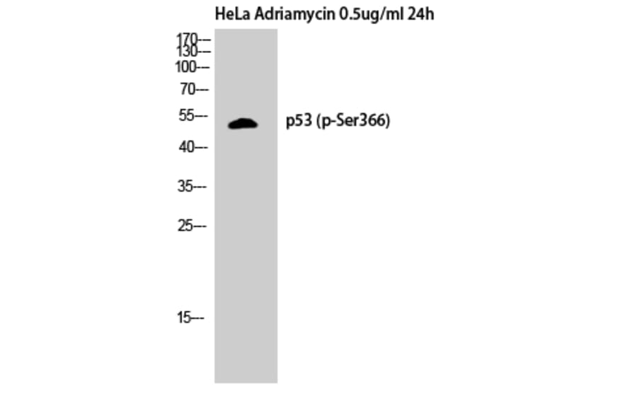 Western Blot - Anti-p53 (phospho Ser366) Antibody (A8053) - Antibodies.com