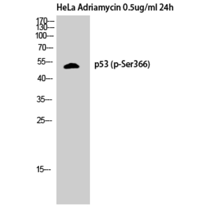 Western Blot - Anti-p53 (phospho Ser366) Antibody (A8053) - Antibodies.com