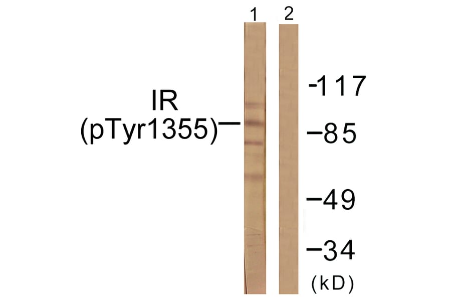 Western Blot - Anti-IR (phospho Tyr1355) Antibody (A0493) - Antibodies.com