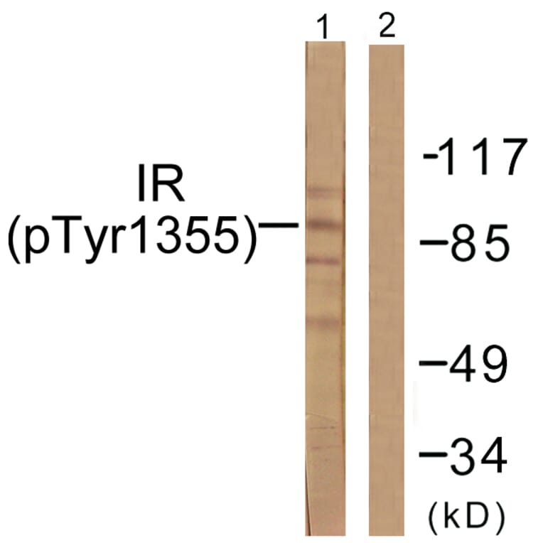 Western Blot - Anti-IR (phospho Tyr1355) Antibody (A0493) - Antibodies.com