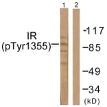 Western Blot - Anti-IR (phospho Tyr1355) Antibody (A0493) - Antibodies.com