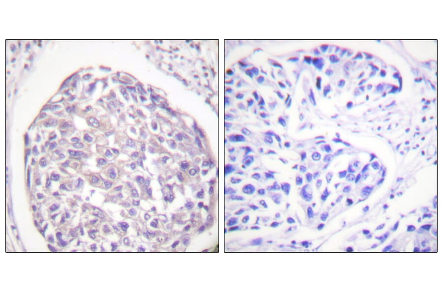 Immunohistochemistry - Anti-IR (phospho Tyr1355) Antibody (A0493) - Antibodies.com