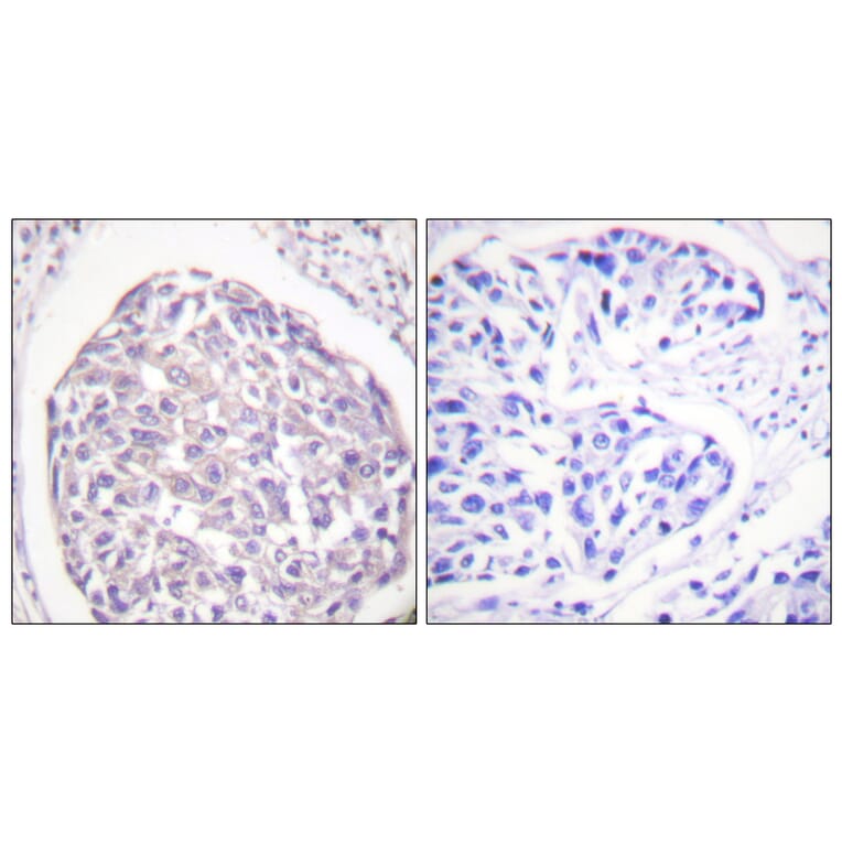 Immunohistochemistry - Anti-IR (phospho Tyr1355) Antibody (A0493) - Antibodies.com