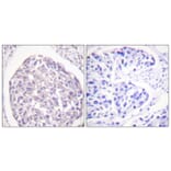 Immunohistochemistry - Anti-IR (phospho Tyr1355) Antibody (A0493) - Antibodies.com