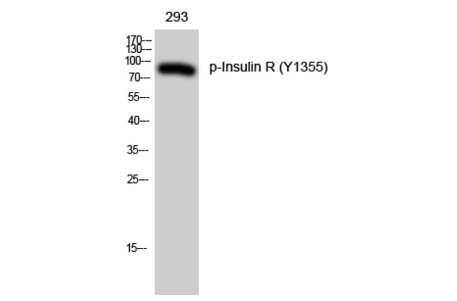 Western Blot - Anti-IR (phospho Tyr1355) Antibody (A0493) - Antibodies.com