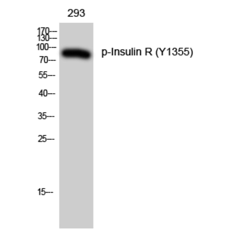 Western Blot - Anti-IR (phospho Tyr1355) Antibody (A0493) - Antibodies.com