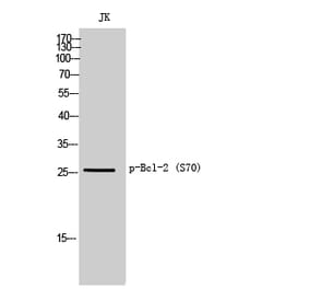 Western Blot - Anti-BCL2 (phospho Ser70) Antibody (A8490) - Antibodies.com