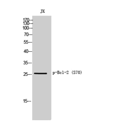 Western Blot - Anti-BCL2 (phospho Ser70) Antibody (A8490) - Antibodies.com