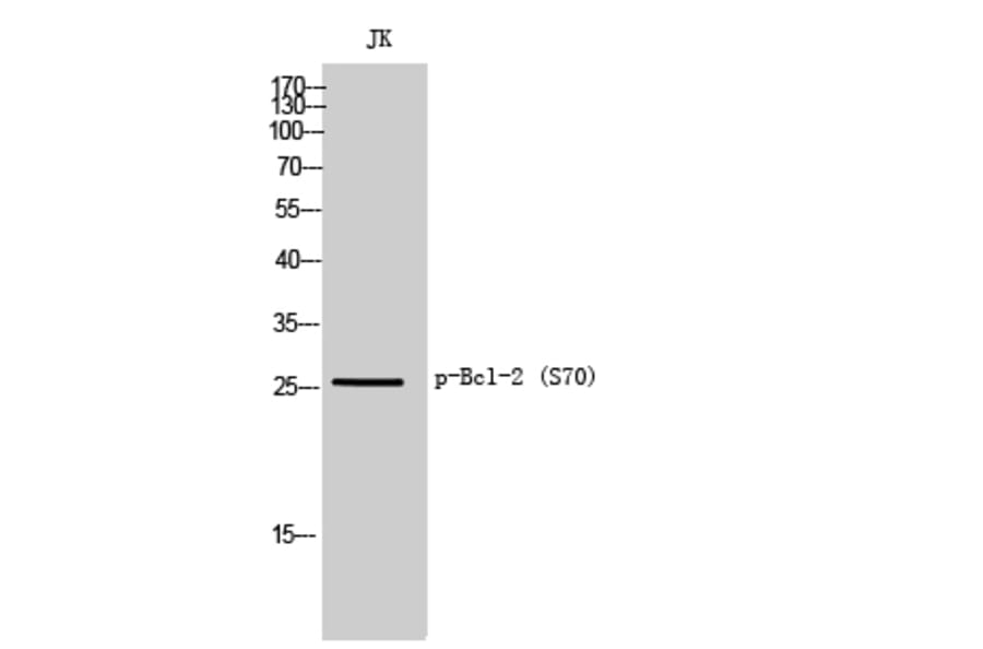 Western Blot - Anti-BCL2 (phospho Ser70) Antibody (A8490) - Antibodies.com