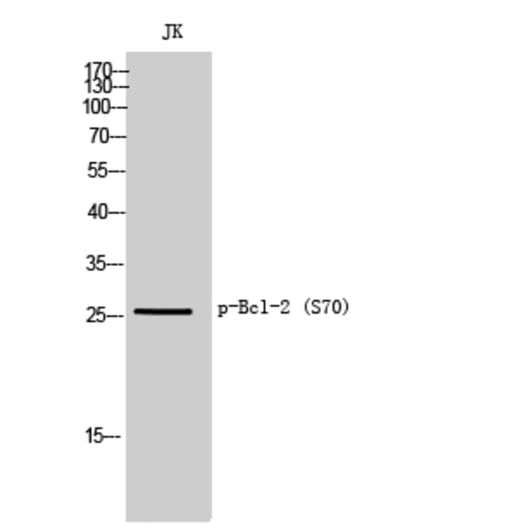 Western Blot - Anti-BCL2 (phospho Ser70) Antibody (A8490) - Antibodies.com