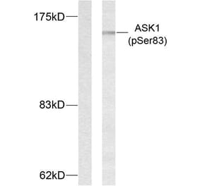 Western Blot - Anti-ASK1 (phospho Ser83) Antibody (A7010) - Antibodies.com