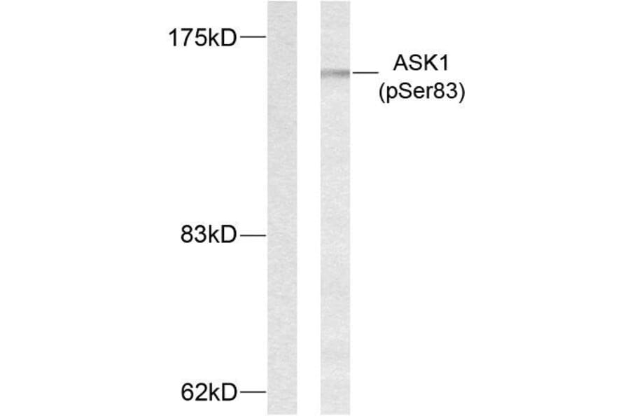Western Blot - Anti-ASK1 (phospho Ser83) Antibody (A7010) - Antibodies.com