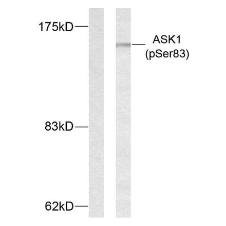 Western Blot - Anti-ASK1 (phospho Ser83) Antibody (A7010) - Antibodies.com
