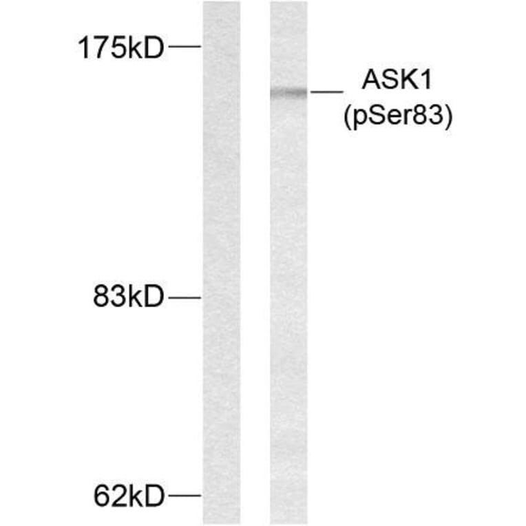 Western Blot - Anti-ASK1 (phospho Ser83) Antibody (A7010) - Antibodies.com