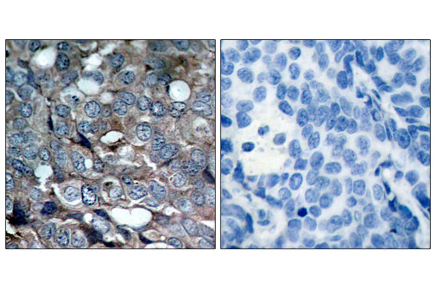 Immunohistochemistry - Anti-ASK1 (phospho Ser83) Antibody (A7010) - Antibodies.com