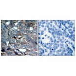 Immunohistochemistry - Anti-ASK1 (phospho Ser83) Antibody (A7010) - Antibodies.com
