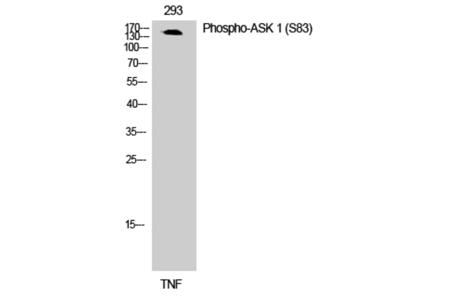Western Blot - Anti-ASK1 (phospho Ser83) Antibody (A7010) - Antibodies.com