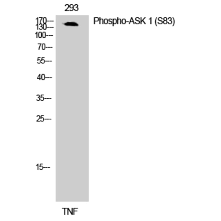 Western Blot - Anti-ASK1 (phospho Ser83) Antibody (A7010) - Antibodies.com
