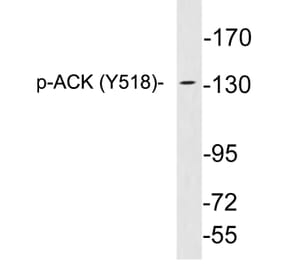 Western Blot - Anti-ACK (phospho Tyr518) Antibody (P12-1001) - Antibodies.com